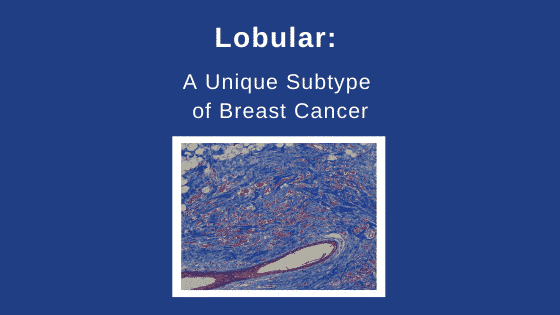 factsheet-ilc-a-unique-subtype-of-breast-cancer-the-lobular-breast