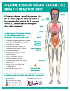 Graphic of the signs and symptoms of metastatic lobular breast cancer