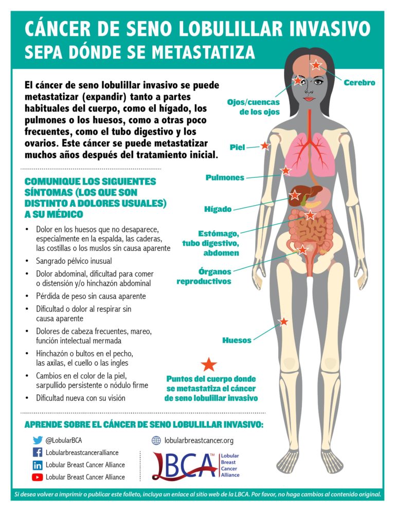 Symptoms of Metastatic ILC in Spanish graphic