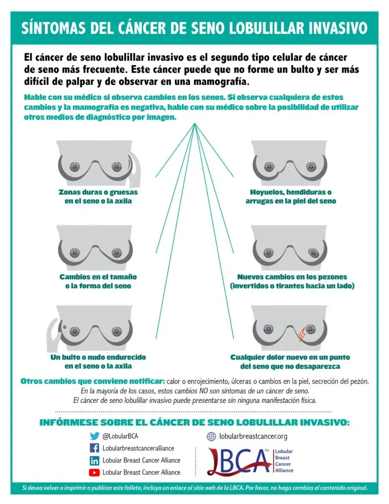 Graphic of the signs of invasive lobular carcinoma