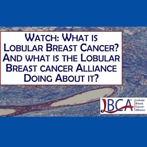 What Is Lobular Breast Cancer Movie Slide