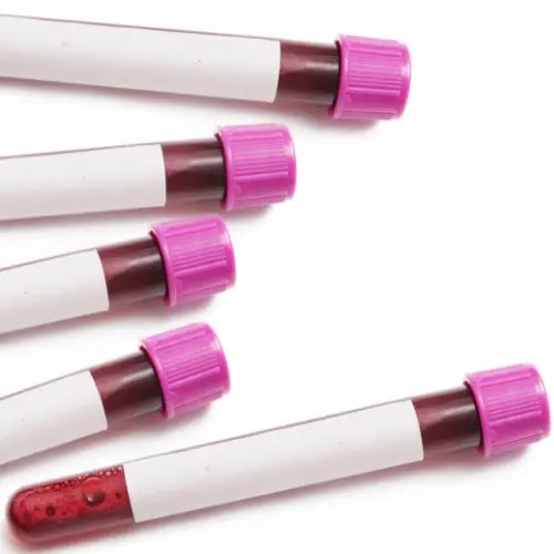 blood in vials